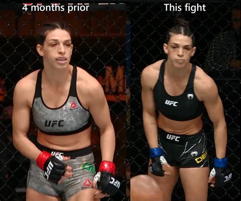 UFCs Mackenzie Dern opens up on having breast implants and。